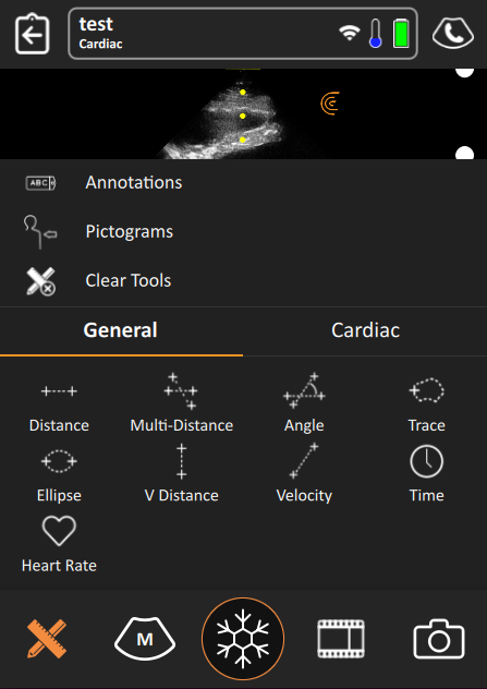 mceclip3.png