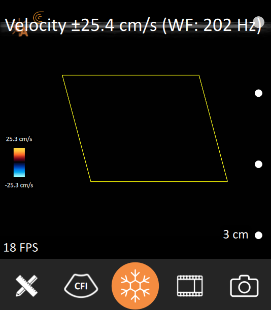 Imaging Modes – Clarius Support