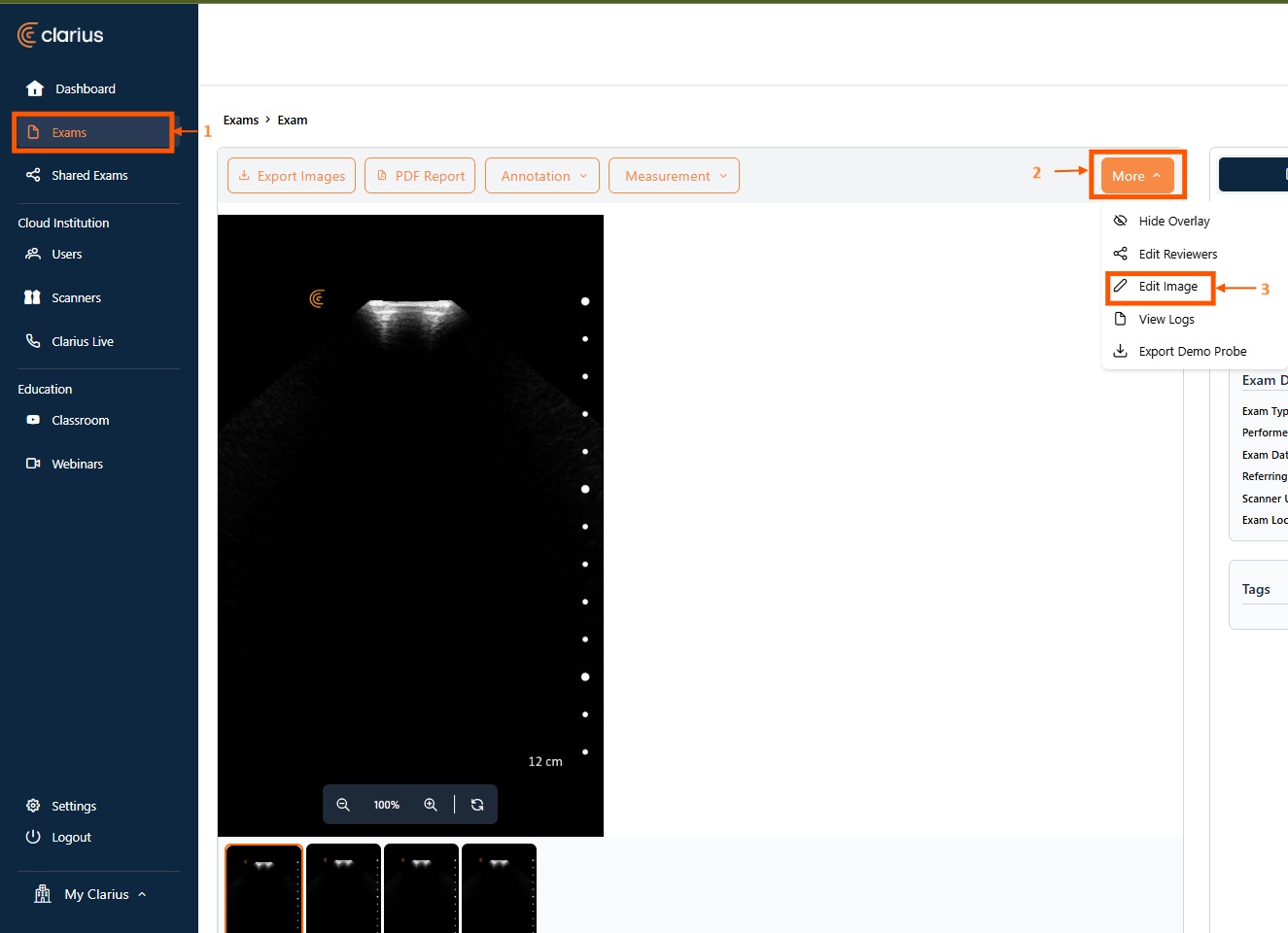 Archiving and Restoring Images or Cineloops within an Exam